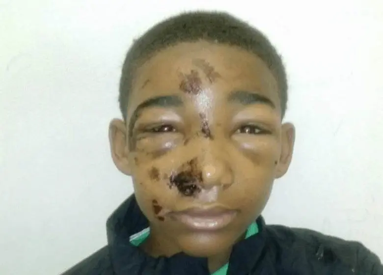 Editorial: 14-Year-Old Black PA Teen Another Victim Of Police Brutality???